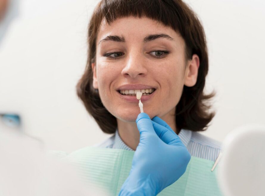 Faccette Estetiche a Roma