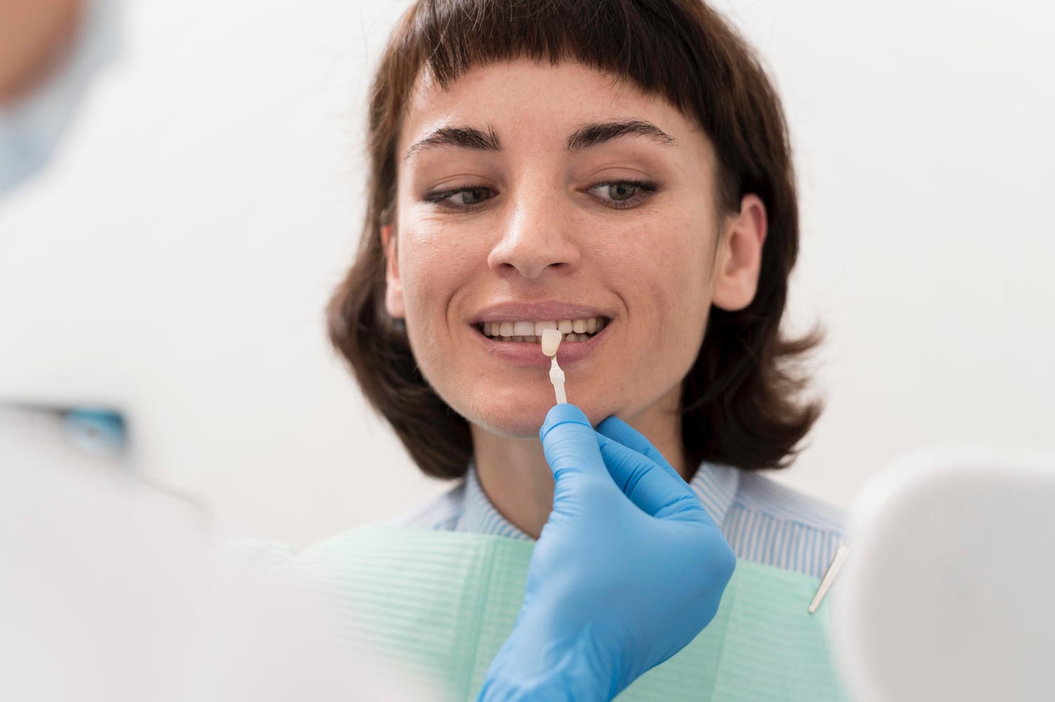 Faccette Estetiche a Roma