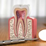 endodonzia