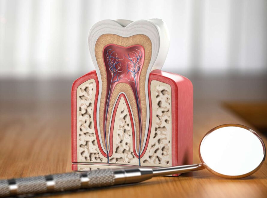 endodonzia