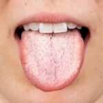 lingua bianca