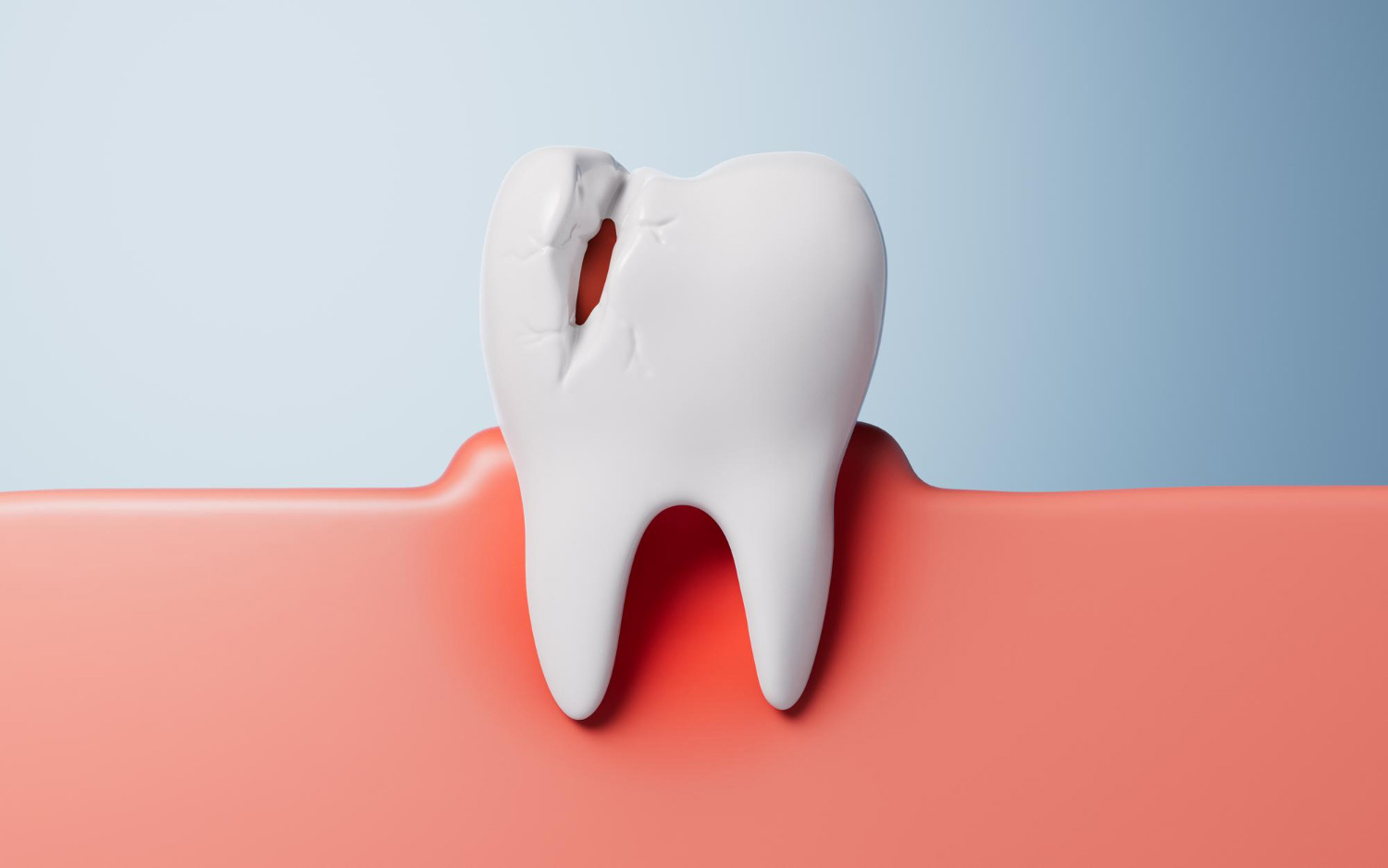 dente incrinato